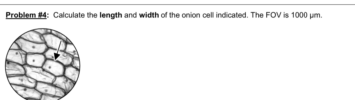 Problem #4: Calculate the length and width of the onion cell indicated. The FOV is 1000 μm.