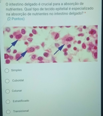 intestino delgado é crucial para a absorção de
nutrientes. Qual tipo de tecido epitelial é especializado
na absorção de nutrientes no intestino delgado? *
(2 Pontos)
Simples
Cuboidal
Colunar
Estratificado
Transicional