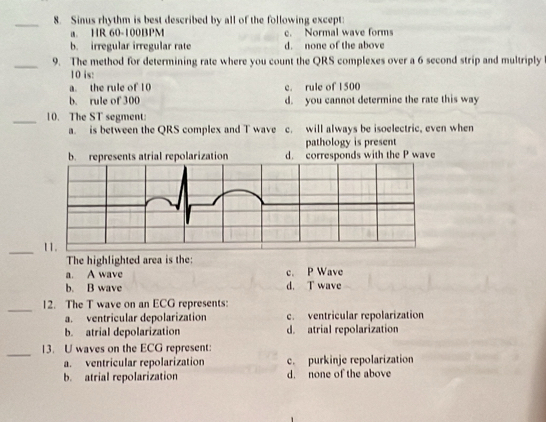Solved: Sinus rhythm is best described by all of the following except ...
