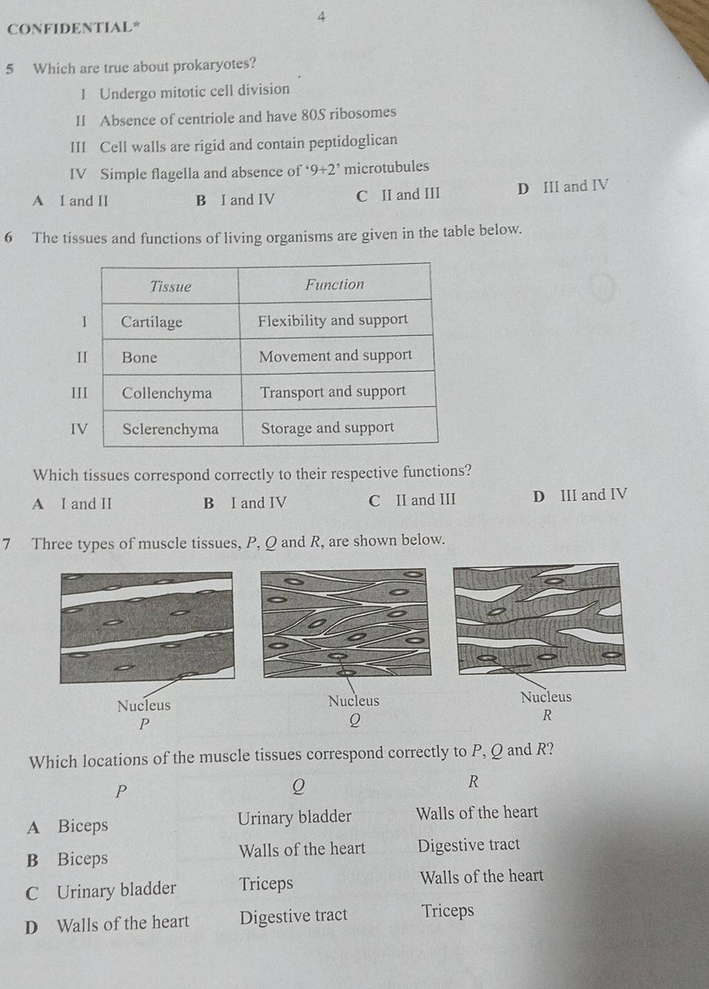 CONFIDENTIAL*
5 Which are true about prokaryotes?
1 Undergo mitotic cell division
II Absence of centriole and have 80S ribosomes
III Cell walls are rigid and contain peptidoglican
IV Simple flagella and absence of '9+9+2^, microtubules
A I and II B I and IV C II and III D III and IV
6 The tissues and functions of living organisms are given in the table below.
Which tissues correspond correctly to their respective functions?
A I and II B I and IV C II and III D III and IV
7 Three types of muscle tissues, P, Q and R, are shown below.
Nucleus Nucleus
Nucleus
P
Q
R
Which locations of the muscle tissues correspond correctly to P, Q and R?
P
Q
R
A Biceps Urinary bladder Walls of the heart
B Biceps Walls of the heart Digestive tract
C Urinary bladder Triceps
Walls of the heart
D Walls of the heart Digestive tract Triceps