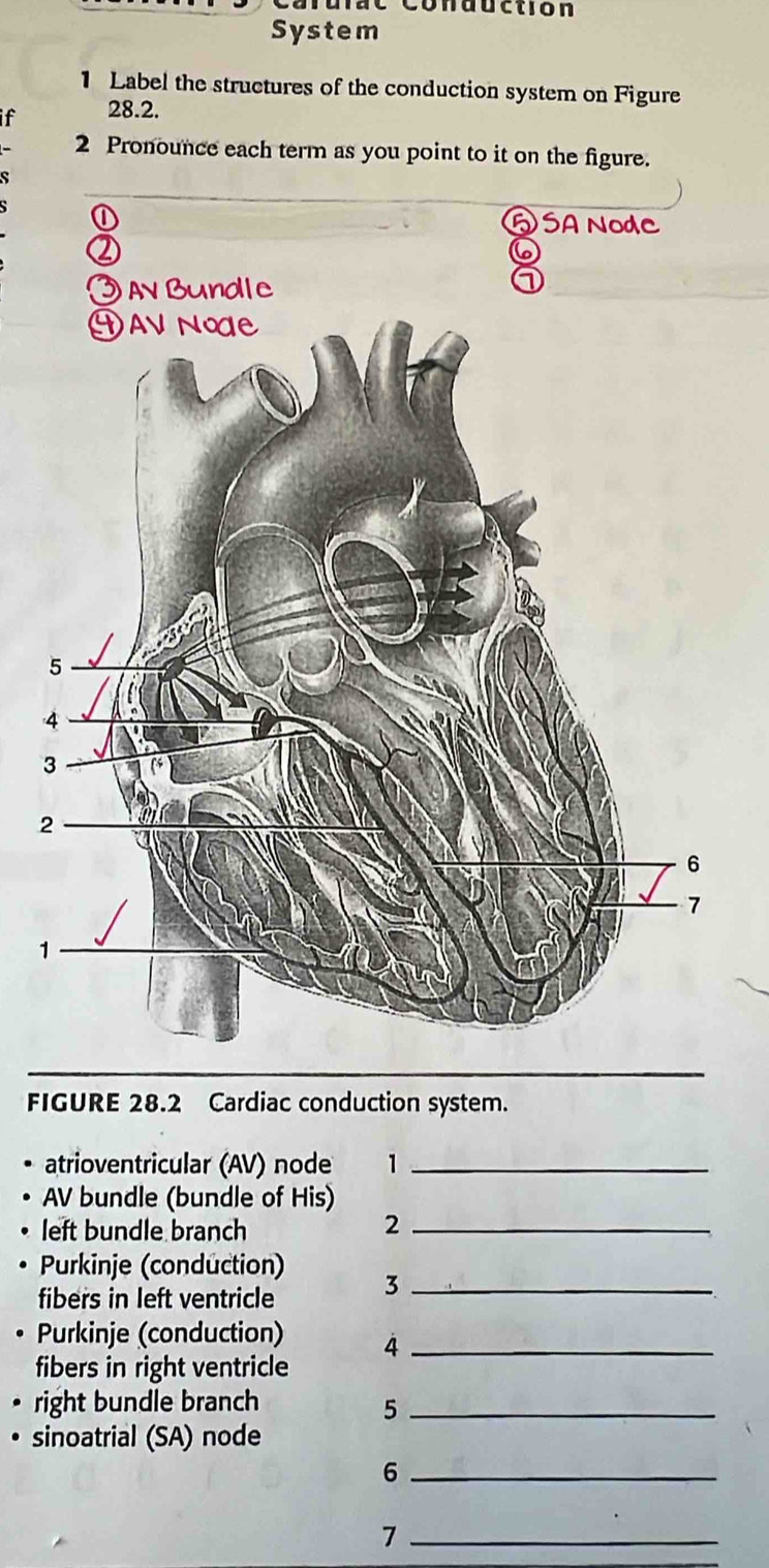 Solved: Carurac Conduction System 1 Label the structures of the ...