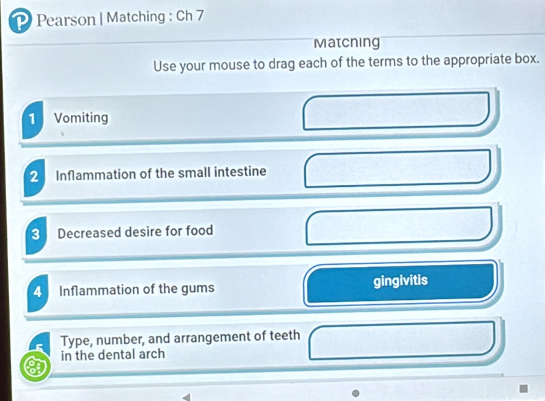 Pearson | Matching : Ch 7 
Matcning 
Use your mouse to drag each of the terms to the appropriate box. 
1 Vomiting 
2 Inflammation of the small intestine 
3 Decreased desire for food 
4 Inflammation of the gums gingivitis 
Type, number, and arrangement of teeth 
in the dental arch