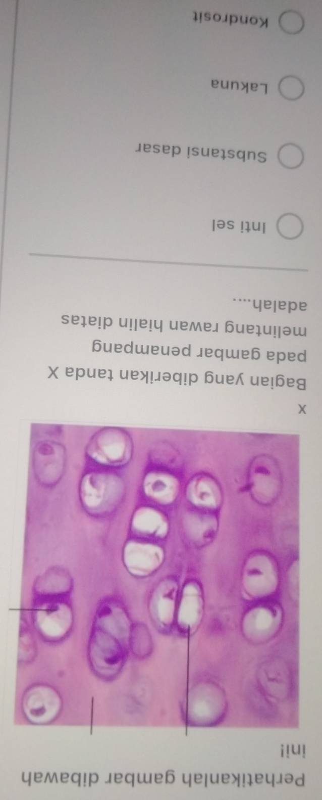 Perhatikanlah gambar dibawah
ini!
X
Bagian yang diberikan tanda X
pada gambar penampang
melintang rawan hialin diatas
adalah....
Inti sel
Substansi dasar
Lakuna
Kondrosit