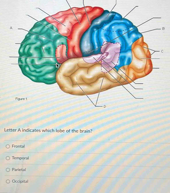 Letter A indicates which lobe of the brain?
Frontal
Temporal
Parietal
Occipital