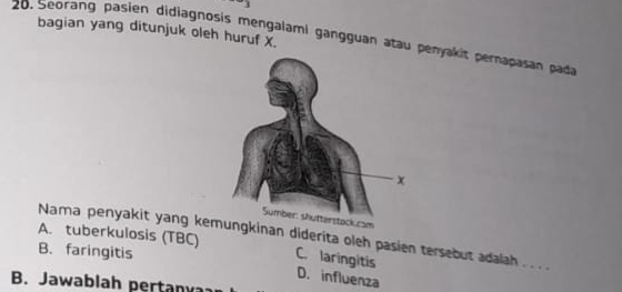 Seorang pasien didiagnosis mengalami gangguan atau penyakit pernapasan pada bagian yang ditunjuk oleh huruf X.
ck.cam
Nama penyakit yang kemungkinan diderita oleh pasien tersebut adalah . . . .
B. faringitis
A. tuberkulosis (TBC) C. laringitis D. influenza
B. Jawablah pertanya