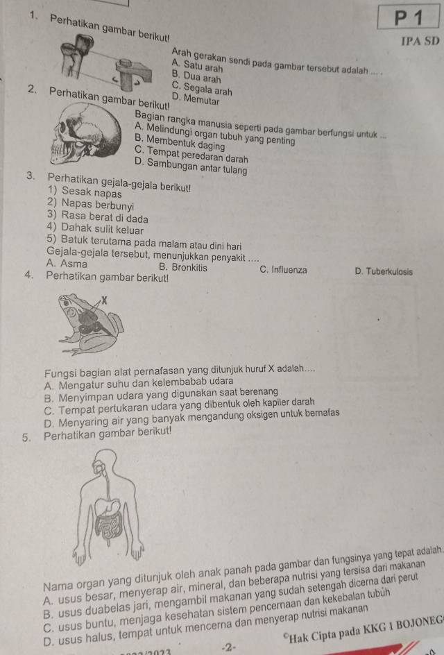 1
1. Perhatikan gambar berikut
IPA SD
Arah gerakan sendi pada gambar tersebut adalah ... .
A. Satu arah
B. Dua arah C. Segala arah
2.an gar berikut!
D. Memutar
Bagian rangka manusia seperti pada gambar berfungsi untuk ...
A. Melindungi organ tubuh yang penting
B. Membentuk daging
C. Tempat peredaran darah
D. Sambungan antar tulang
3. Perhatikan gejala-gejala berikut!
1) Sesak napas
2) Napas berbunyi
3) Rasa berat di dada
4) Dahak sulit keluar
5) Batuk terutama pada malam atau dini hari
Gejala-gejala tersebut, menunjukkan penyakit ....
A. Asma B. Bronkitis C. Influenza D. Tuberkulosis
4. Perhatikan gambar berikut!
Fungsi bagian alat pernafasan yang ditunjuk huruf X adalah....
A. Mengatur suhu dan kelembabab udara
B. Menyimpan udara yang digunakan saat berenang
C. Tempat pertukaran udara yang dibentuk oleh kapiler darah
D. Menyaring air yang banyak mengandung oksigen untuk bernafas
5. Perhatikan gambar berikut!
Nama organ yang ditunjuk oleh anak panah pada gambar dan fungsinya yang tepat adalah
A. usus besar, menyerap air, mineral, dan beberapa nutrisi yang tersisa dari makanan
B. usus duabelas jari, mengambil makanan yang sudah setengah dicerna dari perut
C. usus buntu, menjaga kesehatan sistem pencernaan dan kekebalan tubüh
D. usus halus, tempat untuk mencerna dan menyerap nutrisi makanan
*Hak Cipta pada KKG 1 BOJONEG
-2-