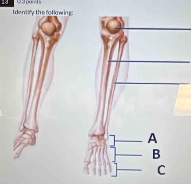 13 0.3 points 
Identify the following: