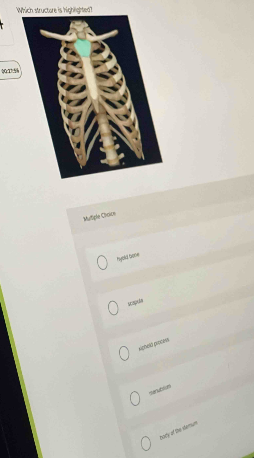 Which structure is highlighted?
00:27:56
Multiple Choice
hyold bone
scapula
xiphold process
manubrium
body of the sternum