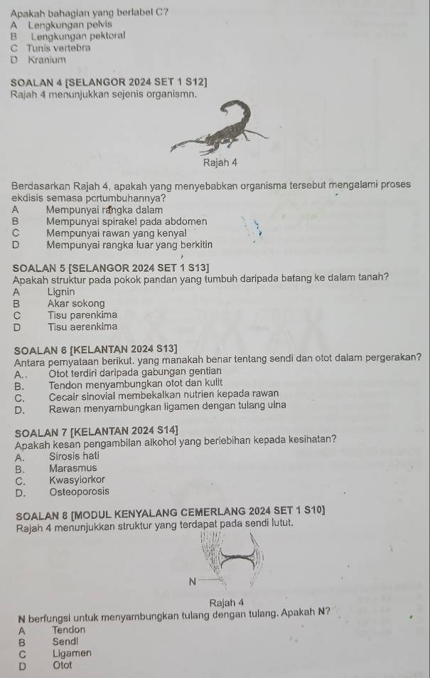 Apakah bahagian yang berlabel C?
A Lengkungan pelvis
B Lengkungan pektoral
C Tunis vartebra
D Kranium
SOALAN 4 [SELANGOR 2024 SET 1 S12]
Rajah 4 menunjukkan sejenis organismn.
Berdasarkan Rajah 4, apakah yang menyebabkan organisma tersebut mengalami proses
ekdisis semasa pcrtumbuhannya?
P Mempunyai rangka dalam
B     Mempunyai spirake! pada abdomen
C Mempunyai rawan yang kenya!
D Mempunyai rangka luar yang berkitin
SOALAN 5 [SELANGOR 2024 SET 1 S13]
Apakah struktur pada pokok pandan yang tumbuh daripada batang ke dalam tanah?
A Lignin
B Akar sokong
C Tisu parenkima
D Tisu aerenkima
SOALAN 6 [KELANTAN 2024 S13]
Antara pemyataan berikut. yang manakah benar tentang sendi dan otot dalam pergerakan?
A.. Otot terdiri daripada gabungan gentian
B. Tendon menyambungkan otot dan kulit
C. Cecair sinovial membekalkan nutrien kepada rawan
D. Rawan menyambungkan ligamen dengan tulang ulna
SOALAN 7 [KELANTAN 2024 S14]
Apakah kesan pengambilan alkohol yang beriebihan kepada kesihatan?
A. Sirosis hati
B. Marasmus
C. Kwasyiorkor
D. Osteoporosis
SOALAN 8 [MODUL KENYALANG CEMERLANG 2024 SET 1 S10]
Rajah 4 menunjukkan struktur yang terdapat pada sendi lutut.
Rajah 4
N berfungsi untuk menyarbungkan tulang dengan tulang. Apakah N?
A Tendon
B Sendl
C Ligamen
D Otot