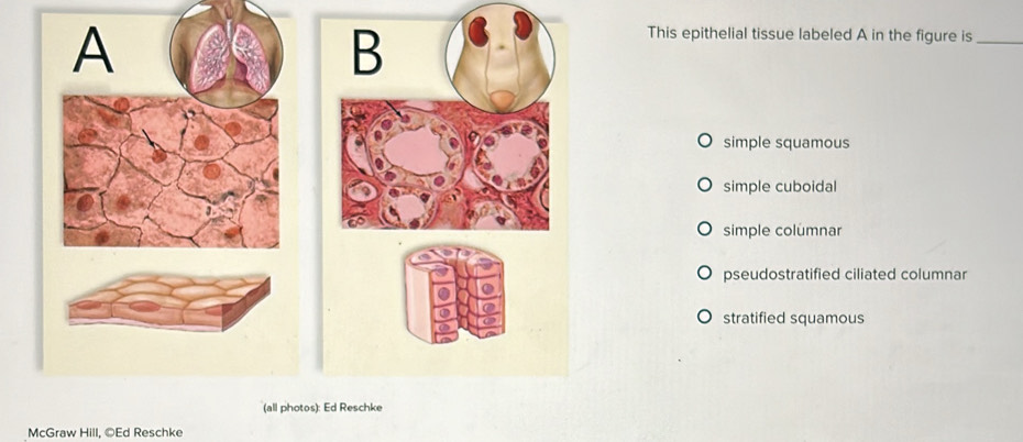 Solved: This epithelial tissue labeled A in the figure is_ simple ...