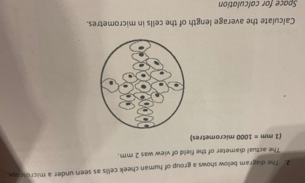 The diagram below shows a group of human cheek cells as seen under a microscope. 
The actual diameter of the field of view was 2 mm.
(1mm=1000 micrometres) 
Calculate the average length of the cells in micrometres. 
Space for calculation