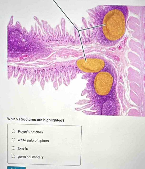 Peyer's patches
white pulp of spleen
tonsils
germinal centers