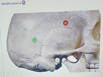 Identify suture at D