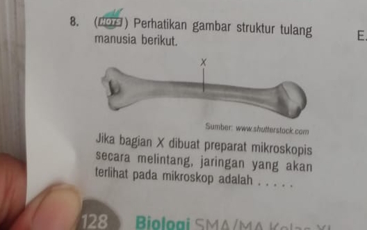 (2O ) Perhatikan gambar struktur tulang E. 
manusia berikut. 
Sumber: www.shutterstock.com 
Jika bagian X dibuat preparat mikroskopis 
secara melintang, jaringan yang akan 
terlihat pada mikroskop adalah . . . . . 
28 0 Biologi SMA/MA K el