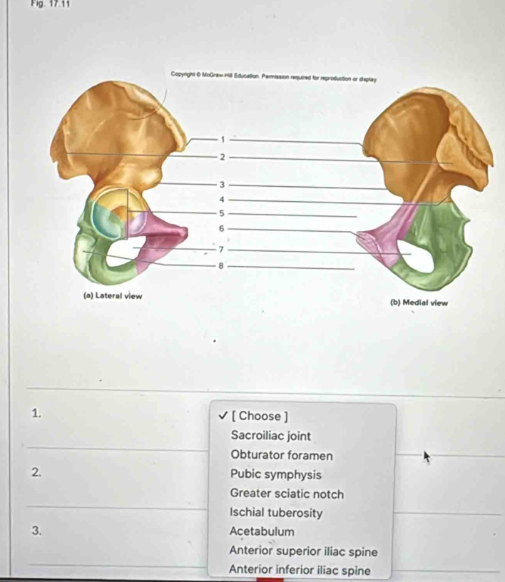 Fig. 17.11 
_ 
1. [ Choose ] 
_ 
Sacroiliac joint 
Obturator foramen 
2. Pubic symphysis 
Greater sciatic notch 
_ 
Ischial tuberosity 
3. Acetabulum 
Anterior superior iliac spine 
_ 
Anterior inferior iliac spine