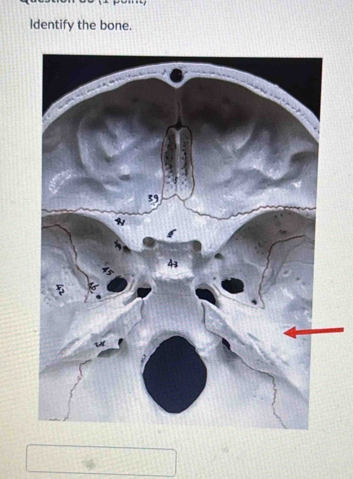 Identify the bone.