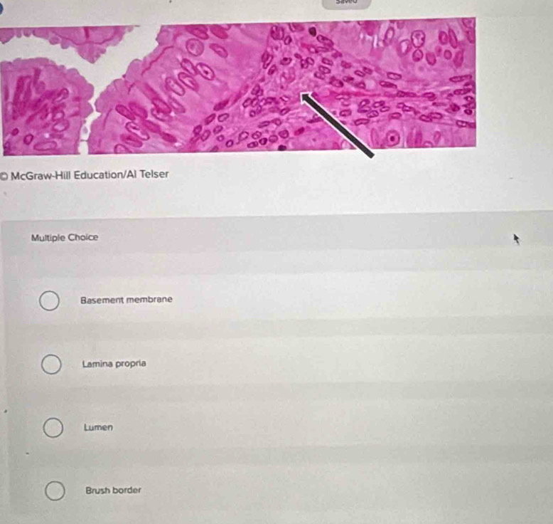 McGraw-Hill Education/Al Telser
Multiple Choice
Basement membrane
Lamina propria
Lumen
Brush border