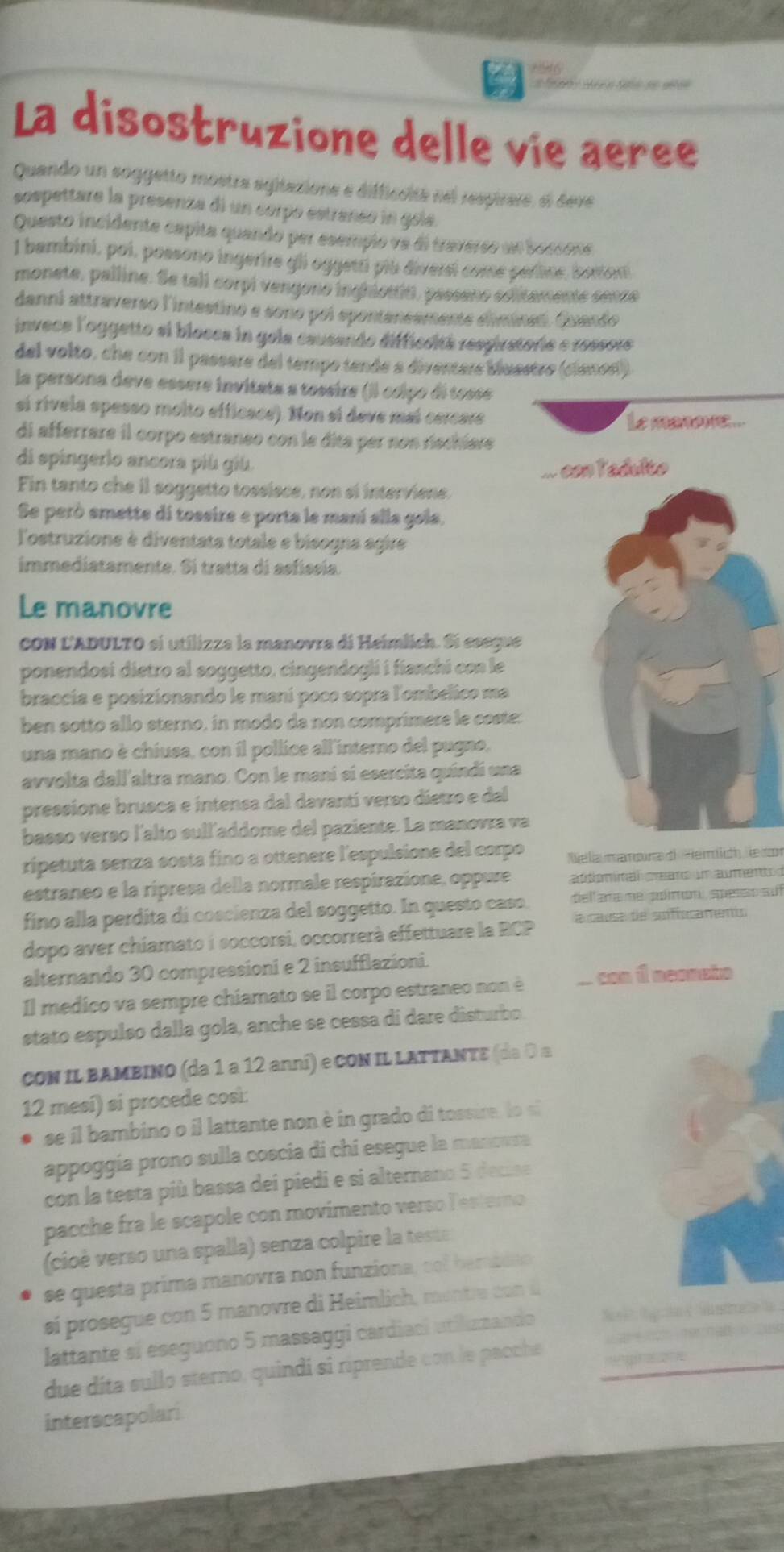 La disostruzione delle vie aeree
Quando un soggetto mostra agitazione e difficaita sel respirere, el devé
sospettare la presenza di un corpó estrancó in gole
Questo incidente capita quando per esempio ve di traverso un bessone
1 bambini, poi, possono ingerire gli oggeti plu diversi come perine, boxon
monete, palline. Se tall corpi vengono inghottitt, passeno editamente sense
danni attraverso l'intestino e sono poi epontanesmente eliminet. Guando
invece l'oggetto si blocea in gola causando difficsità respiratorie e ressore
del volto, che con il passare del tempo tende a diventars bluastro (cianos)
la persona deve essere invitata a tessire (il ccipo di tosse
sí rívela spesso molto efficace). Non sí deve mai cercere
Le matone...
di afferrare il corpo estraneo con le dita per non rschlare
di spingerio ancora più giù
... con ladulto
Fin tanto che il soggetto tossisce, non si interviene.
Se però emette di tossire e porta le maní alla gola,
Tostruzione è diventata totale e bisogna agire
immediatamente. Si tratta di asfíssía.
Le manovre
CON L'ADULTO si utilizza la manovra di Heimlich. Si eseque
ponendosi dietro al soggetto, cingendogli i fíanchi con le
braccia e posizionando le maní poco sopra l'ombelico ma
ben sotto allo sterno, in modo da non comprímere le coste:
una mano è chiusa, con il pollice all'interno del pugno,
avvolta dall'altra mano. Con le mani sí esercita quíndí una
pressione brusca e intensa dal davantí verso dietro e dal
basso verso l'alto sull'addome del paziente. La manovra va
ripetuta senza sosta fino a ottenere l'espulsione del corpo  Nella mampuma d He rlcn le don
estraneo e la ripresa della normale respirazione, oppure adtomimal crearo um aumento d
fino alla perdita di coscienza del soggetto. In questo caso, dellana me pomon, speso auf
dopo aver chiamato i soccorsi, occorrerà effettuare la RCP a causa de asfiscaments
alternando 30 compressioni e 2 insufflazioni.
Il medico va sempre chiamato se il corpo estraneo non è con 1 aeonsio
stato espulso dalla gola, anche se cessa di dare disturbo
CON IL BAMBINO (da 1 a 12 anni) e CON IL LATTANTE (da 0 a
12 mesi) si procede così:
se il bambino o il lattante non è in grado di tossire lo s
appoggía prono sulla coscia di chi esegue la manoura
con la testa più bassa dei piedi e si alternano 5 decise
pacche fra le scapole con movimento verso lesterno
(cioè verso una spalla) senza colpire la teste
se questa prima manovra non funziona, cof bambdno
sí prosegue con 5 manovre di Heimlich, montre con u
lattante si eseguono 5 massaggi cardiaci utilizzando       
due díta sullo sterno, quindí si riprende con le pacche
interscapolari