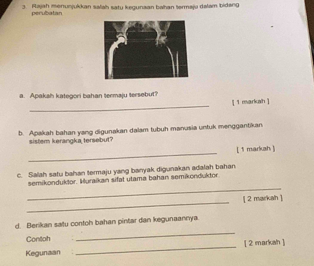 Rajah menunjukkan salah satu kegunaan bahan termaju dalam bidang 
perubatan 
a. Apakah kategori bahan termaju tersebut? 
_ 
[ 1 markah ] 
b. Apakah bahan yang digunakan dalam tubuh manusia untuk menggantikan 
sistem kerangka tersebut? 
_ 
[ 1 markah ] 
c. Salah satu bahan termaju yang banyak digunakan adalah bahan 
_ 
semikonduktor. Huraikan sifat utama bahan semikonduktor. 
_ 
[ 2 markah ] 
_ 
d. Berikan satu contoh bahan pintar dan kegunaannya. 
Contoh 
Kegunaan _[ 2 markah ]