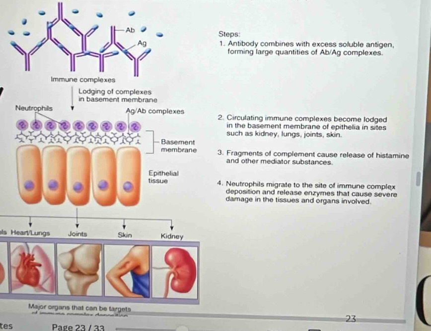 Steps: 
1. Antibody combines with excess soluble antigen, 
forming large quantities of Ab/Ag complexes. 
2. Circulating immune complexes become lodged 
in the basement membrane of epithelia in sites 
such as kidney, lungs, joints, skin. 
3. Fragments of complement cause release of histamine 
and other mediator substances. 
4. Neutrophils migrate to the site of immune complex 
deposition and release enzymes that cause severe 
damage in the tissues and organs involved. 
ls Hear/Lungs 
23 
tes Page 23 / 33