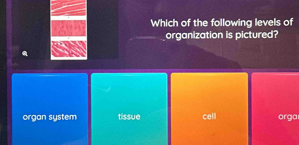 Which of the following levels of
organization is pictured?
organ system tissue cell orga