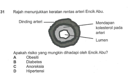 Rajah menunjukkan keratan rentas arteri Encik Abu.
Apakah risiko yang mungkin dihadapi oleh Encik Abu?
A Obesiti
B Diabetes
C Anoreksia
D Hipertensi