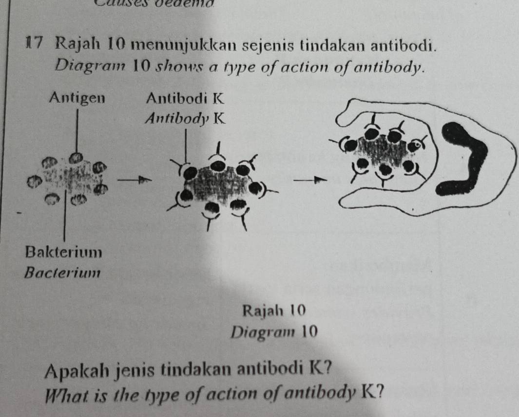 a us es oedemo 
17 Rajah 10 menunjukkan sejenis tindakan antibodi. 
Diagram 10 shows a type of action of antibody. 
Rajah 10 
Diagram 10 
Apakah jenis tindakan antibodi K? 
What is the type of action of antibody K?