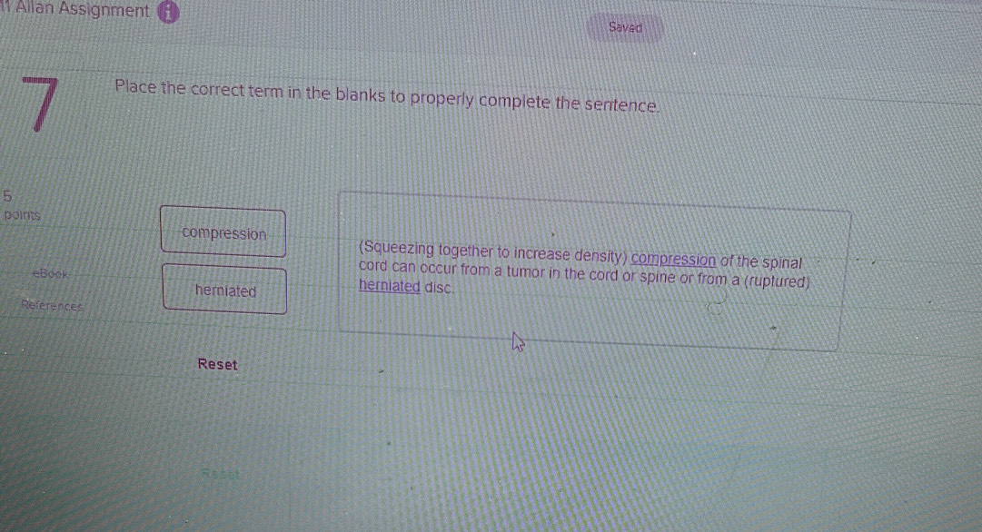 Allan Assignment Savad 
7 
Place the correct term in the blanks to properly complete the sentence. 
5 
points 
compression (Squeezing together to increase density) compression of the spinal 
cord can occur from a tumor in the cord or spine or from a (ruptured) 
eBook herniated disc 
herniated 
References 
Reset