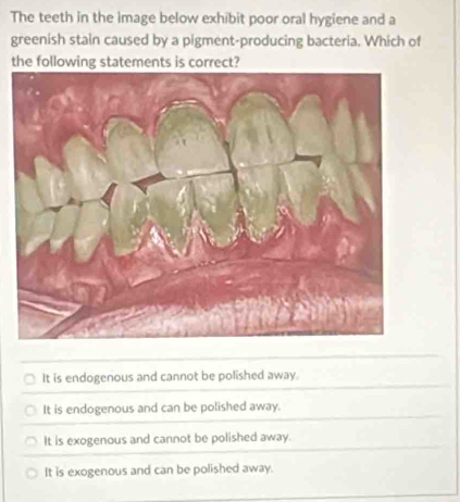 The teeth in the image below exhibit poor oral hygiene and a
greenish stain caused by a pigment-producing bacteria. Which of
the following statements is correct?
It is endogenous and cannot be polished away.
It is endogenous and can be polished away.
It is exogenous and cannot be polished away.
It is exogenous and can be polished away.