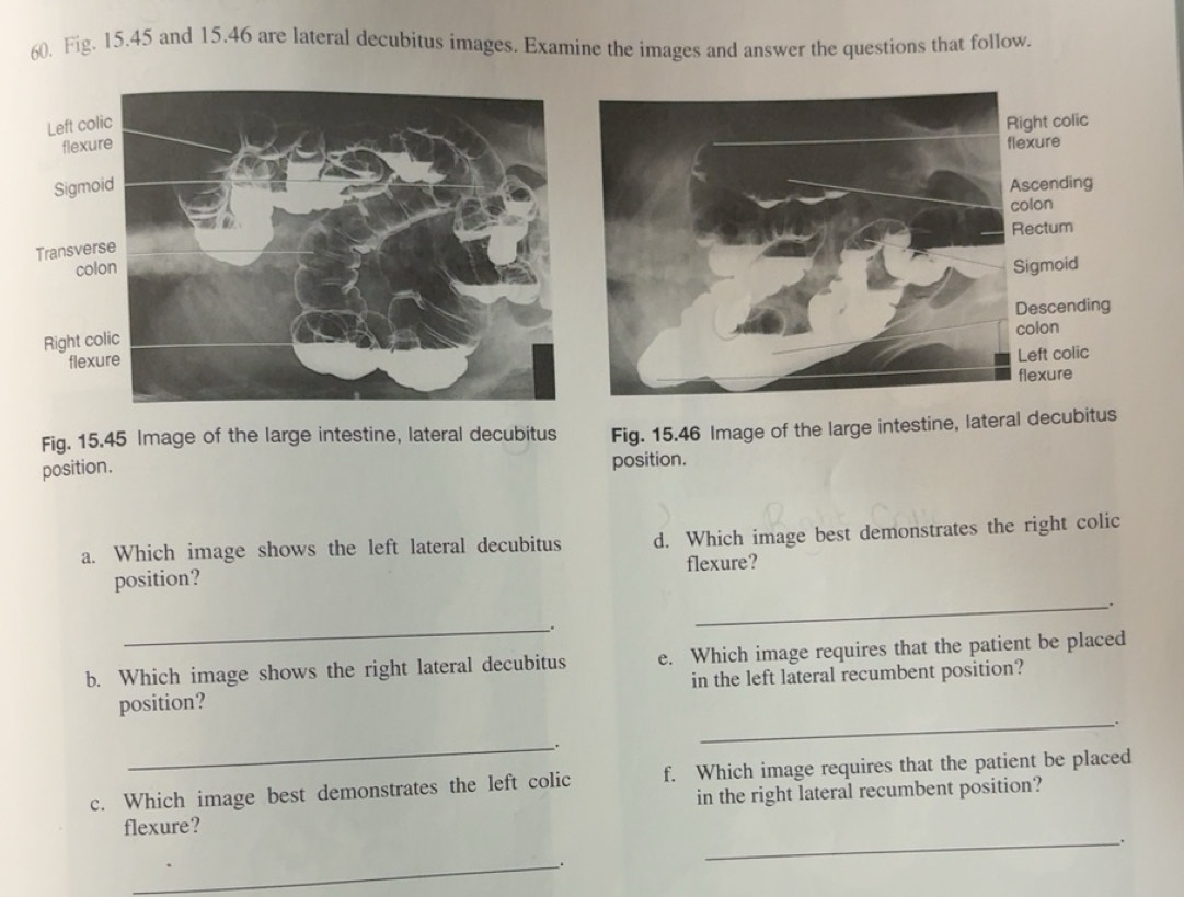 Solved: Fig. 15.45 and 15.46 are lateral decubitus images. Examine the ...