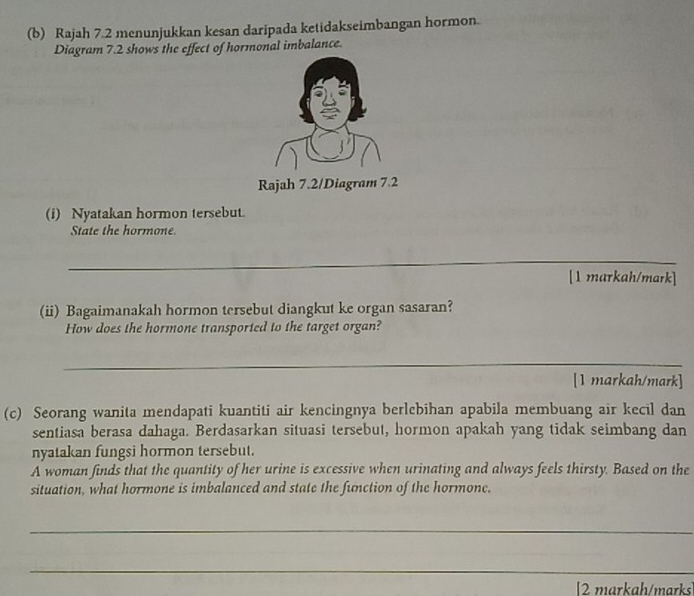 Rajah 7.2 menunjukkan kesan daripada ketidakseimbangan hormon 
Diagram 7.2 shows the effect of hormonal imbalance. 
Rajah 7.2/Diagram 7.2 
(i) Nyatakan hormon tersebut 
State the hormone. 
_ 
[1 markah/mark] 
(ii) Bagaimanakah hormon tersebut diangkut ke organ sasaran? 
How does the hormone transported to the target organ? 
_ 
[1 markah/mark] 
(c) Seorang wanita mendapati kuantiti air kencingnya berlebihan apabila membuang air kecil dan 
sentiasa berasa dahaga. Berdasarkan situasi tersebut, hormon apakah yang tidak seimbang dan 
nyatakan fungsi hormon tersebut. 
A woman finds that the quantity of her urine is excessive when urinating and always feels thirsty. Based on the 
situation, what hormone is imbalanced and state the function of the hormone. 
_ 
_ 
[2 markah/marks