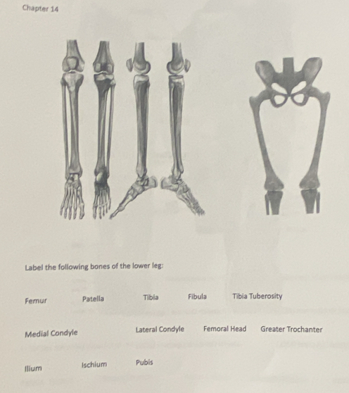 Chapter 14
Label the following bones of the lower leg:
Femur Patella Tibia Fibula Tibia Tuberosity
Medial Condyle Lateral Condyle Femoral Head Greater Trochanter
Ilium Ischium Pubis