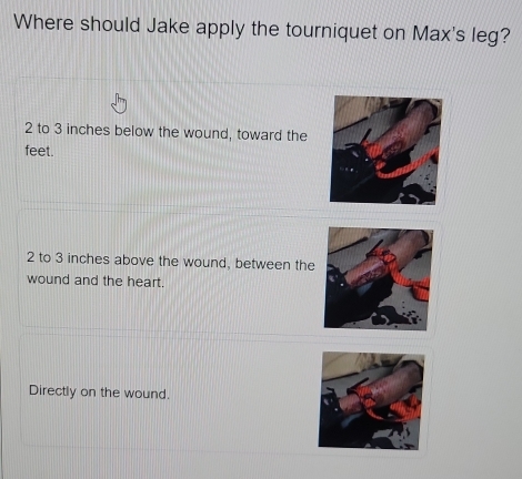 Solved: Where should Jake apply the tourniquet on Max's leg? 2 to 3 ...