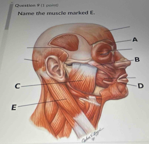 Name the muscle marked E.