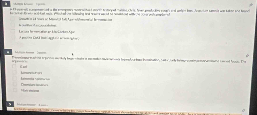 Multiple Arwer 3 points
A 49-year-old man presented to the emergency room with a 3-month history of malaise, chills, fever, productive cough, and weight loss. A sputum sample was taken and found
to contain Gram- acid-fast rods. Which of the following test results would be consistent with the observed symptoms?
Growth in 24 hours on Mannitol Salt Agar with mannitol fermentation
A positive Mantoux skin test
Lactose fermentation on MacConkey Agar
A positive CAST (cold-agglutin screening test)
Mulligle Aromer 2 pomts
The endospores of this organism are likely to germinate in anaerobic environments to produce food intoxication, particularly In improperly preserved home canned foods. The
organism is
E. call
Salmonella typhi
Salmonella typhimurium
Clostridium botullinum
Vibrio cholerme
Mulkiats Anmer 3 points
Antibiotic-associated colitis (shown in (b) the bottom picture below; normal colon is shown in the top (a) picture), a major cause of diarrhea in he