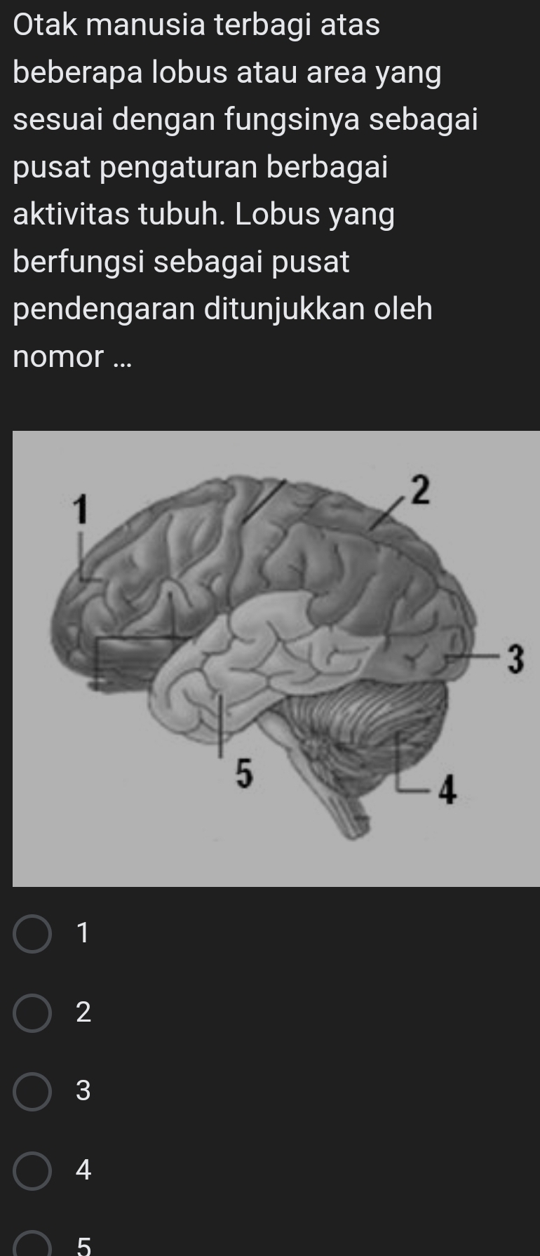Otak manusia terbagi atas
beberapa lobus atau area yang
sesuai dengan fungsinya sebagai
pusat pengaturan berbagai
aktivitas tubuh. Lobus yang
berfungsi sebagai pusat
pendengaran ditunjukkan oleh
nomor ...
3
1
2
3
4
5