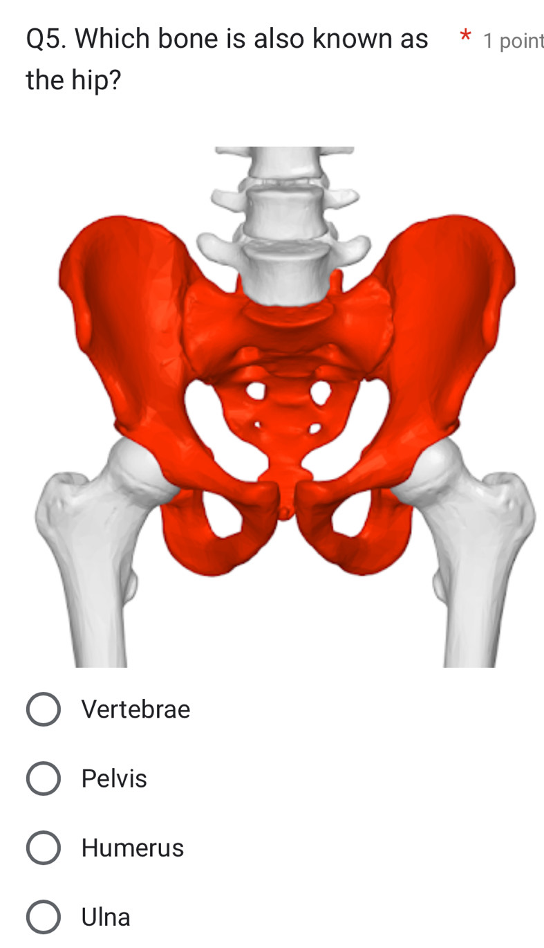 Which bone is also known as * 1 point
the hip?
Vertebrae
Pelvis
Humerus
Ulna