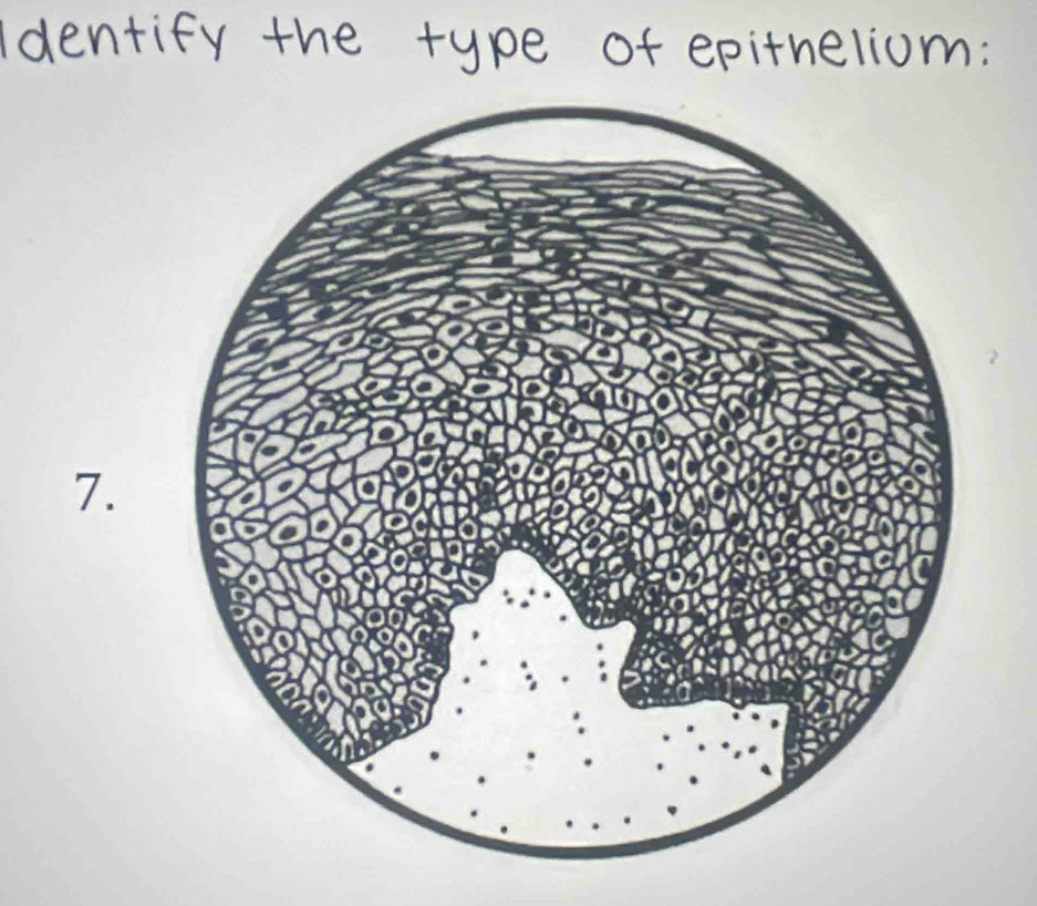 dentify the type of epitheliom: