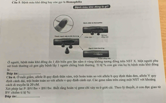 Bệnh máu khó đông hay còn gọi là Hemophilia 
Bệnh máu khó đóng là gi? 
Ở người, bệnh máu khó đông do 1đột biển gen lặn nằm ở vùng không tương đồng trên NST X. Một người phụ 
nữ bình thường có gen gây bệnh lầy 1 người chồng bình thường. Tỉ lệ % con gái của họ bị bệnh máu khó đông 
là:_ 
Đáp án:_ 
Câu 6. Ở ruồi giám, allele B quy định thân xám, trội hoàn toàn so với allele b quy định thân đen, allele V quy 
định cánh dài, trội hoàn toàn so với allele v quy định cánh cụt. Các gene nằm trên cùng một NST với khoảng 
cách di truyền là 20 cM. 
Xét phép lai P: BV//bv* BV//bv. Biết rằng hoán vị gene chỉ xảy ra ở giới cái. Theo lý thuyết, ở con đực giao từ 
BV chiêm tỉ lê % : 
Đáp án:_