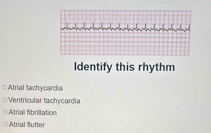 Identify this rhythm
Atrial tachycardia
Ventricular tachycardia
Atrial fibrillation
Atrial flutter