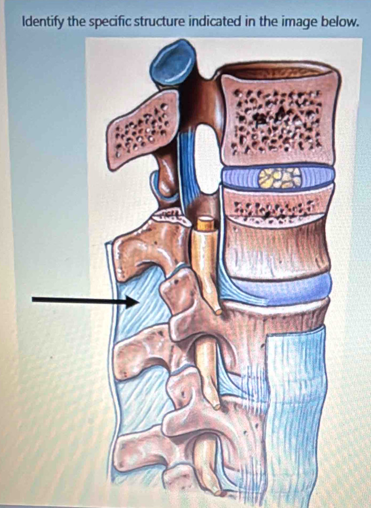 ldentify the specific structure indicated in the image below.
