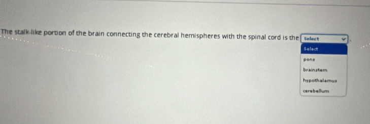 The stalk like portion of the brain connecting the cerebral hemispheres with the spinal cord is the Select
Select
pons
brainstem
hypothalamus
cerebellum