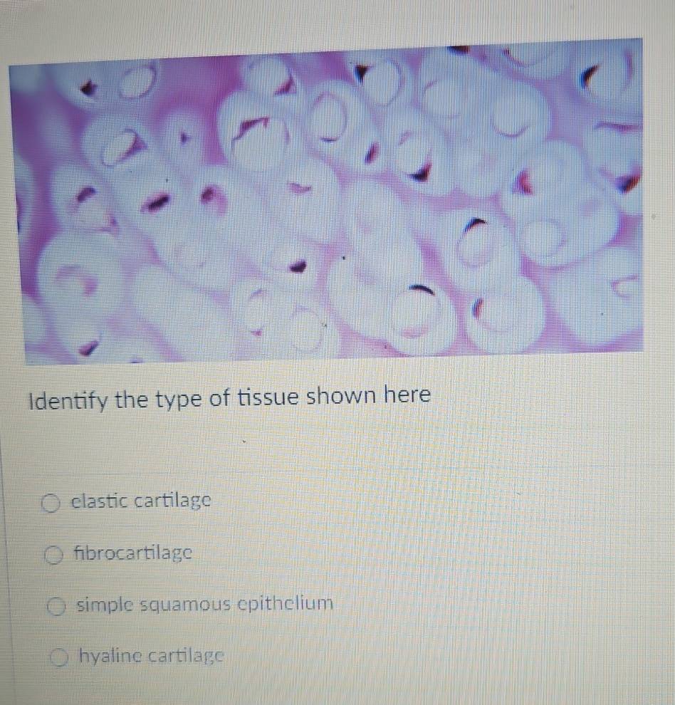 Identify the type of tissue shown here
elastic cartilage
fibrocartilage
simple squamous epithelium
hyaline cartilage