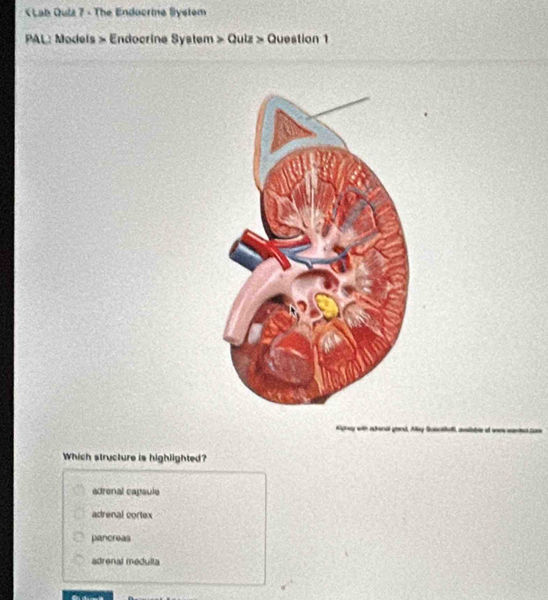 Lab Oula 7 - The Endocrine System
PAL: Models » Endocrine System > Quiz > Question 1
Which structure is highlighted?
adrenal capsule
adrenal cortex
pancreas
adrenal medulta