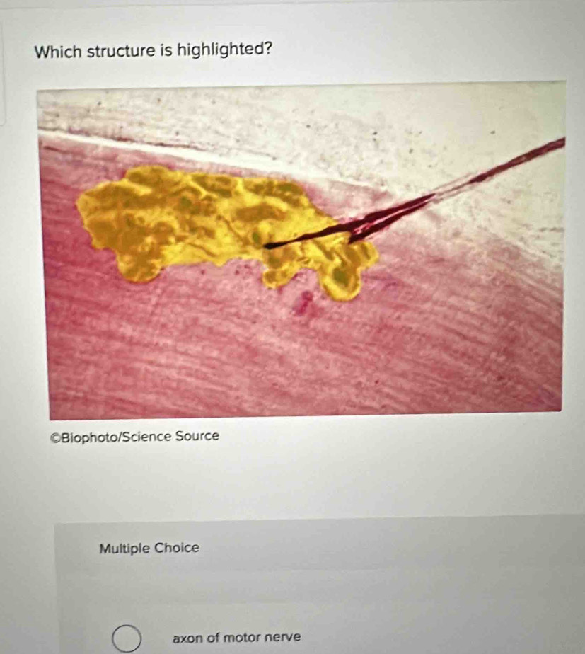 Which structure is highlighted?
©Biophoto/Science Source
Multiple Choice
axon of motor nerve