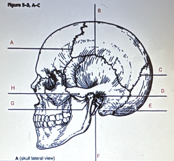 Figure 5-3, A-C 
A (skull lateral view) 
F