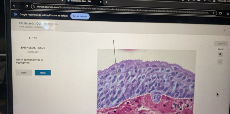 Flashcards: Quiz | PAL 
mylab.pearson.com/Student/WritingSpaceLaunch.aspx?toollaunchmode=do8assignmenttype=P 
Google recommends setting Chrome as default Set as default 
Flashcards: Qui incomolete 
Lab 6 Exercise: Épithelium 
8 / 10 
FUFつ 
EPITHELIAL TISSUEZoom 
HISTOLOGY 
Q 
highlighted? Which epithelial type is 
Back Next