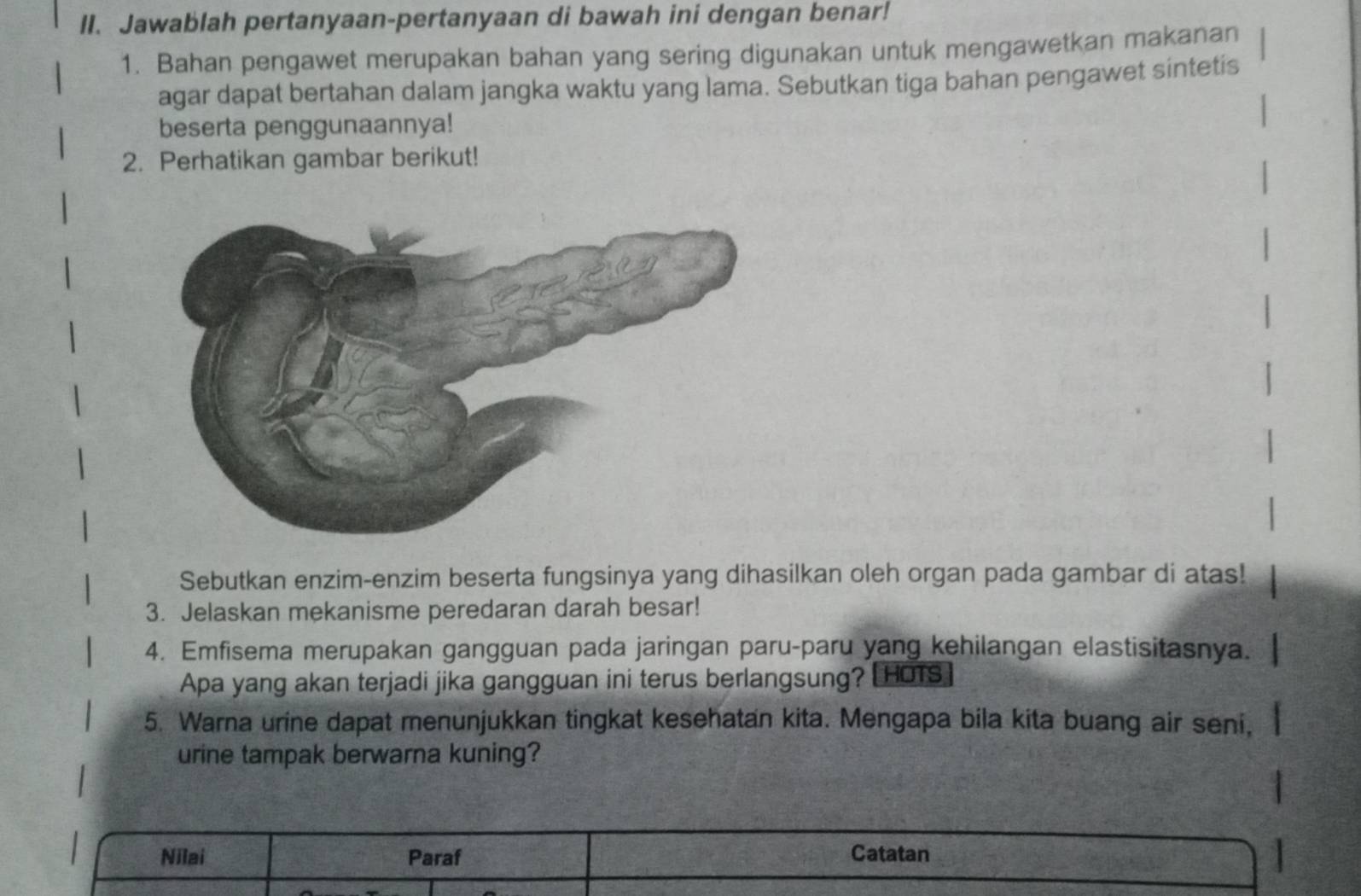 Jawablah pertanyaan-pertanyaan di bawah ini dengan benar! 
1. Bahan pengawet merupakan bahan yang sering digunakan untuk mengawetkan makanan 
agar dapat bertahan dalam jangka waktu yang lama. Sebutkan tiga bahan pengawet sintetis 
beserta penggunaannya! 
2. Perhatikan gambar berikut! 
Sebutkan enzim-enzim beserta fungsinya yang dihasilkan oleh organ pada gambar di atas! 
3. Jelaskan mekanisme peredaran darah besar! 
4. Emfisema merupakan gangguan pada jaringan paru-paru yang kehilangan elastisitasnya. 
Apa yang akan terjadi jika gangguan ini terus berlangsung? [HOTs] 
5. Warna urine dapat menunjukkan tingkat kesehatan kita. Mengapa bila kita buang air seni, 
urine tampak berwarna kuning? 
Nilai Paraf Catatan