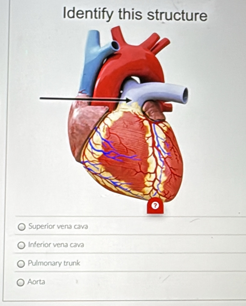 Identify this structure
Superior vena cava
Inferior vena cava
Pulmonary trunk
Aorta