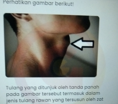 Perhatikan gambar berikut! 
Tulang yang ditunjuk oleh tanda panah 
pada gambar tersebut termasuk dalam 
jenis tulang rawan yang tersusun oleh zat